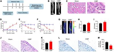 Proteomic analysis of spinal cord tissue in a rat model of cancer-induced bone pain